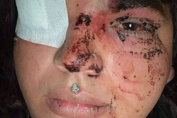 Detienen a cinco mujeres por la paliza que recibió Miss Trans Zamora en un pub de La Bañeza (León) el pasado fin de semana