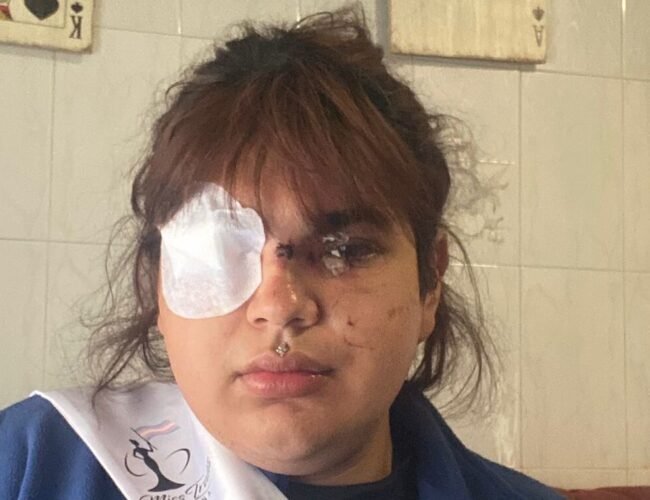 Bianca, Miss Trans Zamora, tras la agresión: «Está todavía con mucho miedo, porque hubo un momento en que se vio muerta»