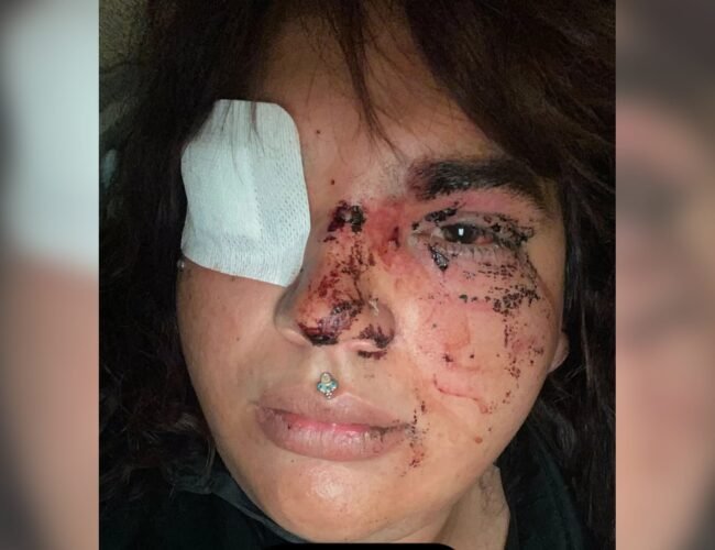 Detenidas cinco mujeres por la agresión tránsfoba ocurrida en un pueblo de León