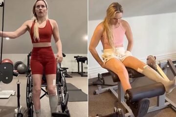 La milagrosa recuperación de Lindsey Vonn: de la casi amputación a ponerse en pie