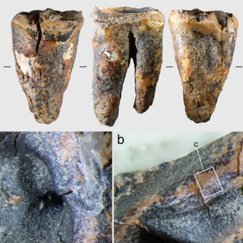 Los neandertales trataban las caries usando herramientas de piedra hace 60.000 años